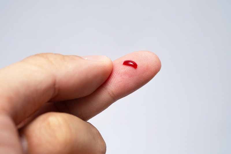 Mơ thấy máu là điềm gì? Giải mã ý nghĩa tốt xấu từ A-Z 