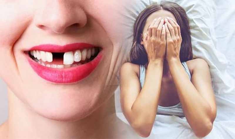 Mơ thấy rụng răng là điềm gì? Giải mã ý nghĩa chuẩn xác từ A-Z